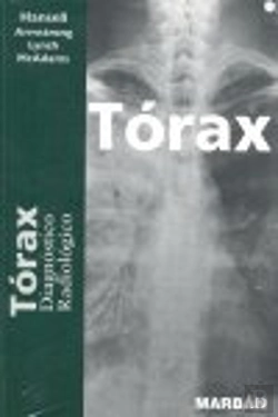 Bertrand.pt - Torax