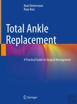 Bertrand.pt - Total Ankle Replacement