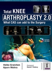 Total Knee Arthroplasty 2.0