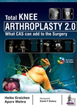 Bertrand.pt - Total Knee Arthroplasty 2.0