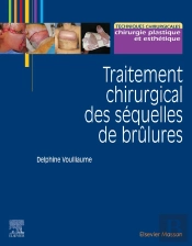 Traitement Chirurgical Des Séquelles De Brûlures