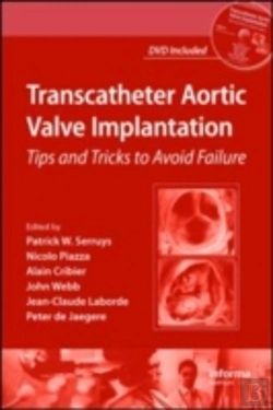 Bertrand.pt - Transcatheter Aortic Valve Implantation