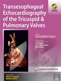 Bertrand.pt - Transesophageal Echocardiography Of The Tricuspid & Pulmonary Valves