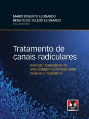 Tratamento de Canais Radiculares