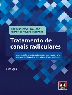 Bertrand.pt - Tratamento de Canais Radiculares
