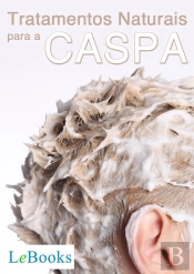 Tratamentos Naturais Para A Caspa