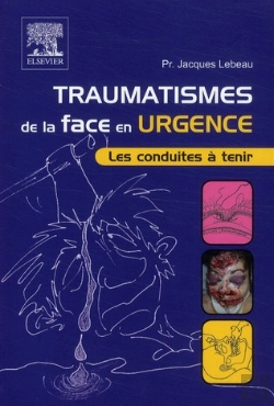 Bertrand.pt - Traumatismes De La Face En Urgence