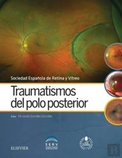 Bertrand.pt - Traumatismos Del Polo Posterior + Acceso Web