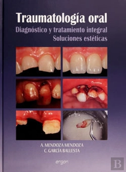 Bertrand.pt - Traumatología Oral
