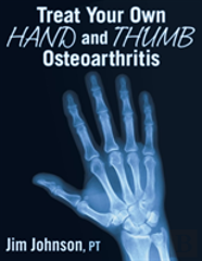 Treat Your Own Hand And Thumb Osteoarthritis