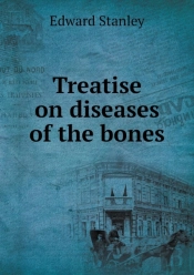 Treatise On Diseases Of The Bones