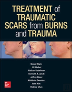 Bertrand.pt - Treatment Of Scars From Burns And Trauma