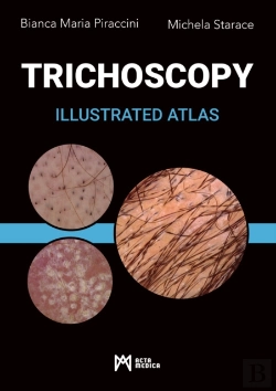 Bertrand.pt - Trichoscopy