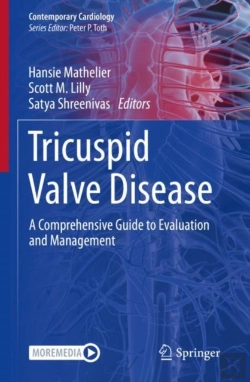 Bertrand.pt - Tricuspid Valve Disease