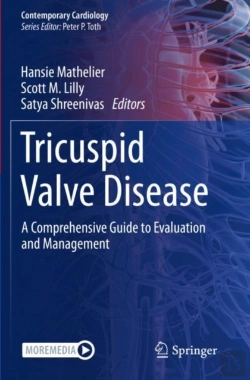 Bertrand.pt - Tricuspid Valve Disease