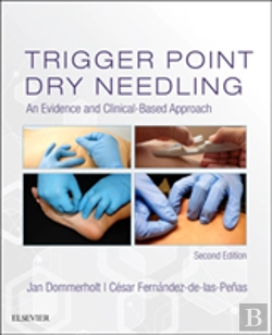 Bertrand.pt - Trigger Point Dry Needling