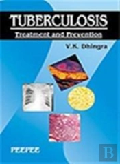 Tuberculosis