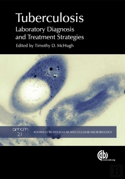 Bertrand.pt - Tuberculosis