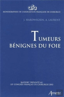 Bertrand.pt - Tumeurs Bénignes Du Foie