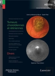 Tumeurs Choroïdiennes Et Rétiniennes ; Divers