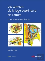 Tumeurs De La Loge Posterieure De L Orbite