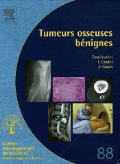 Tumeurs Osseuses Benignes