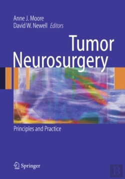 Bertrand.pt - Tumor Neurosurgery