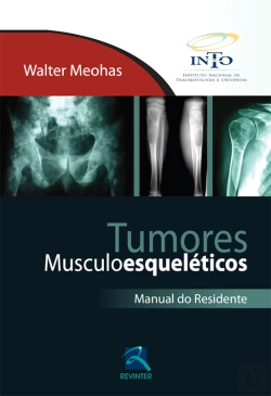 Bertrand.pt - Tumores Musculoesqueléticos