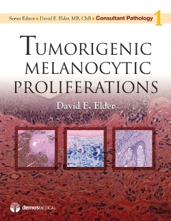 Bertrand.pt - Tumorigenic Melanocytic Proliferations