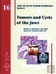 Tumors And Cysts Of The Jaws