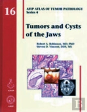 Tumors And Cysts Of The Jaws