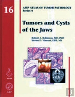 Bertrand.pt - Tumors And Cysts Of The Jaws