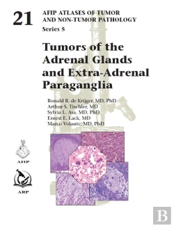 Bertrand.pt - Tumors Of The Adrenal Glands And Extra-Adrenal Paraganglia