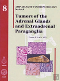 Bertrand.pt - Tumors Of The Adrenal Glands And Extraadrenal Paraganglia