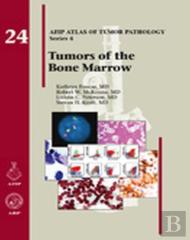 Tumors Of The Bone Marrow