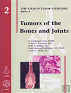 Bertrand.pt - Tumors Of The Bones And Joints