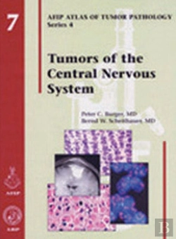 Bertrand.pt - Tumors Of The Central Nervous System