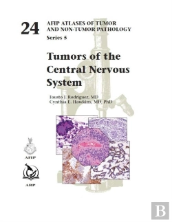 Bertrand.pt - Tumors Of The Central Nervous System