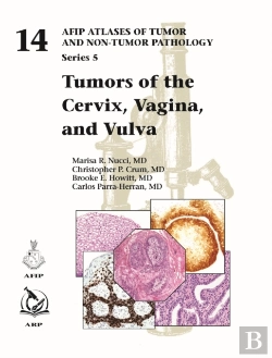 Bertrand.pt - Tumors Of The Cervix, Vagina, And Vulva