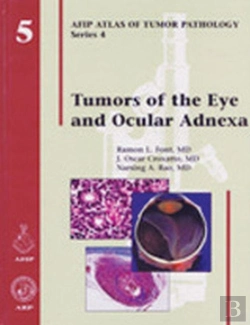 Bertrand.pt - Tumors Of The Eye And Ocular Adnexa