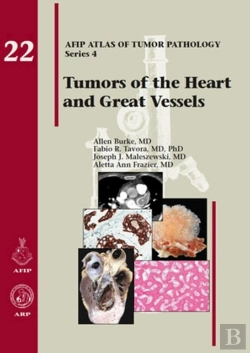 Bertrand.pt - Tumors Of The Heart And Great Vessels