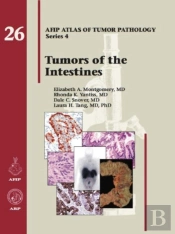 Tumors Of The Intestines
