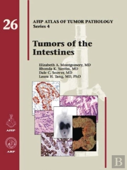 Bertrand.pt - Tumors Of The Intestines