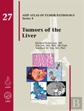 Tumors Of The Liver