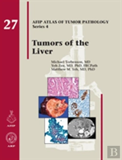 Bertrand.pt - Tumors Of The Liver