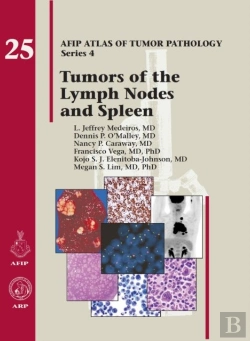 Bertrand.pt - Tumors Of The Lymph Nodes And Spleen