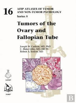 Bertrand.pt - Tumors Of The Ovary And Fallopian Tube