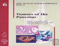 Tumors Of The Pancreas