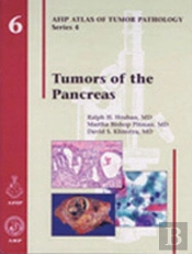 Tumors Of The Pancreas