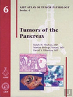 Bertrand.pt - Tumors Of The Pancreas